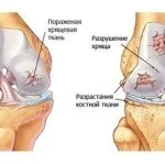 Як стать і вік впливають на розтяжку стретчинг гнучкість тіла (впливають) Як стать і вік впливають на розтяжку стретчинг гнучкість тіла