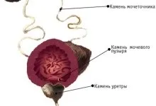 Трави для сечового міхура, лікування (сечового) Трави для сечового міхура, лікування