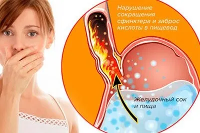 Трясе з похмілля що робити і як з цим боротися (робити) Трясе з похмілля що робити і як з цим боротися