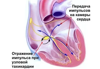 Трясе з похмілля що робити і як з цим боротися (трясе) Трясе з похмілля що робити і як з цим боротися