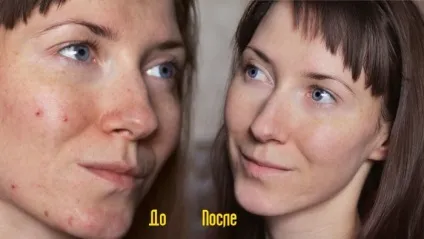 Як зробити пілінг обличчя лимоном