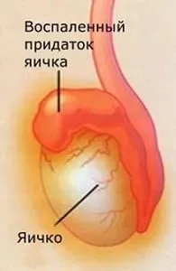 Як виглядає машонкой у чоловіка (машонкой) Як виглядає машонкой у чоловіка