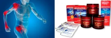 Колаген для суглобів і зв'язок, продукти містять колаген