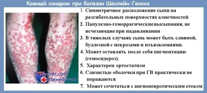 Клініка хвороби Шенлейна-Геноха