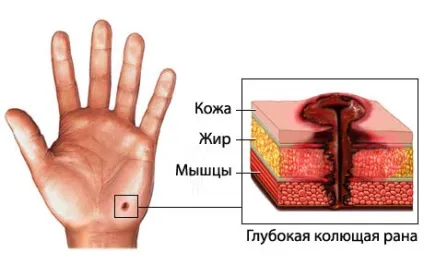 колоті рани