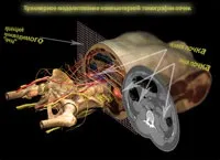 Комп'ютерна томографія нирок, мій уролог
