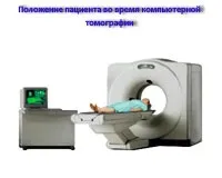 Комп'ютерна томографія нирок, мій уролог