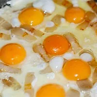 Коронарні судини серця що це таке, будова і види (коронарні) Коронарні судини серця що це таке, будова і види