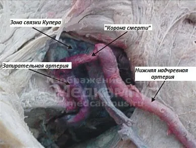 Корона смерті (лат