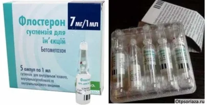 Уколи від псоріазу - види ін'єкцій, особливості лікування, відгуки (псоріазу) Уколи від псоріазу - види ін'єкцій, особливості лікування, відгуки