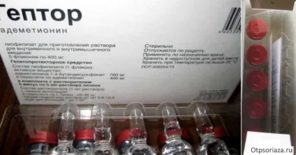 Уколи від псоріазу - види ін'єкцій, особливості лікування, відгуки (уколи) Уколи від псоріазу - види ін'єкцій, особливості лікування, відгуки