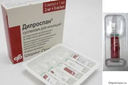 Уколи від псоріазу - види ін'єкцій, особливості лікування, відгуки (Містить активний компонент) Уколи від псоріазу - види ін'єкцій, особливості лікування, відгуки