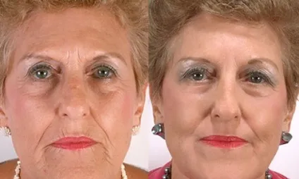 Крем для обличчя після 50 років рейтинг кращих кремів (крем) Крем для обличчя після 50 років рейтинг кращих кремів