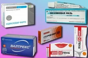 Лабіальний герпес характеристика і лікування захворювання (герпес) Лабіальний герпес характеристика і лікування захворювання
