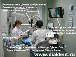 Лікування каналів зубів, обладнання для лікування каналів зубів, мікроскоп дентальний, ендодонтія (лікування) Лікування каналів зубів, обладнання для лікування каналів зубів, мікроскоп дентальний, ендодонтія