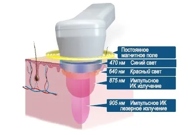 Лазеротерапія та магнитолазеротерапия (лт і МЛТ) - нова клінік (нова) Лазеротерапія та магнитолазеротерапия (лт і МЛТ) - нова клінік