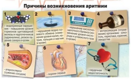 Лікування аритмії в домашніх умовах народними засобами (лікування) Лікування аритмії в домашніх умовах народними засобами
