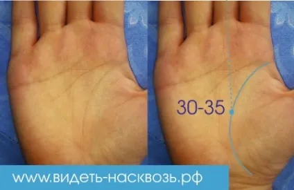 Лінія життя по роках (лінії життя Лінія) Лінія життя по роках