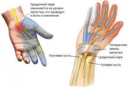 Магнітно-резонансна томографія лучезапястного суглоба і кисті (томографія) Магнітно-резонансна томографія лучезапястного суглоба і кисті
