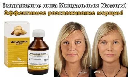 Мигдальне масло застосування для волосся, обличчя, вій і від розтяжок (волосся) Мигдальне масло застосування для волосся, обличчя, вій і від розтяжок