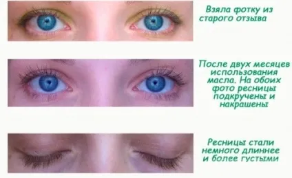 Мигдальне масло застосування для волосся, обличчя, вій і від розтяжок (мигдальне масло застосування для волосся особи вій розтяжок властивості користь використовувати застосовувати косметичний навколо очей) Мигдальне масло застосування для волосся, обличчя, вій і від розтяжок