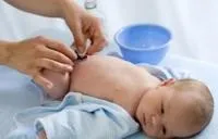 Мокне пупок у новонародженого (пупок) Мокне пупок у новонародженого