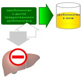Уробилиноген в сечі