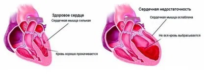 Нічний кашель у дорослого причини, як зупинити, напади, як лікувати, сухий, сильний, лікування (нічний) Нічний кашель у дорослого причини, як зупинити, напади, як лікувати, сухий, сильний, лікування
