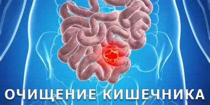 Очищення організму, медична клініка (комплексної детоксикації організму) Очищення організму, медична клініка