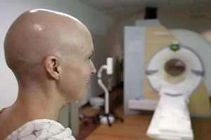 пухлинний ангіогенез