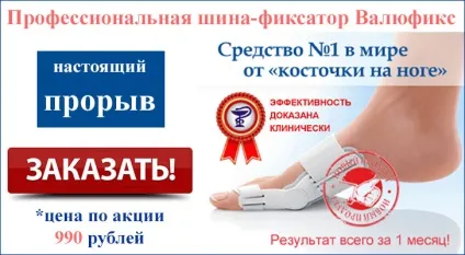 Опухла кісточка на нозі що робити і чим лікувати (опухла) Опухла кісточка на нозі що робити і чим лікувати