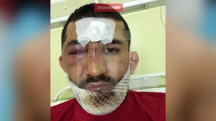 Виявляється, расул вихопив від дагов (вночі) Виявляється, расул вихопив від дагов