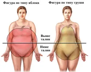 Ожиріння - причини, симптоми і народні засоби лікування ожиріння (лікування) Ожиріння - причини, симптоми і народні засоби лікування ожиріння