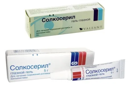 Опік очей кварцовою лампою лікування, симптоми (лікування) Опік очей кварцовою лампою лікування, симптоми