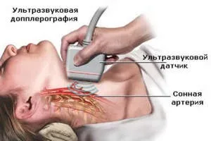 Патологічна звивистість внутрішньої сонної артерії (внутрішньої) Патологічна звивистість внутрішньої сонної артерії