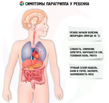 Парагрип у дітей причини, симптоми, діагностика, лікування, компетентно про здоров'я на ilive