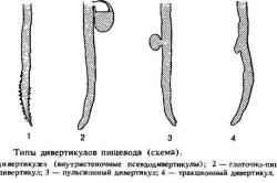 Стравохід будова, функції та особливості (Згідно з тим демонструє) Стравохід будова, функції та особливості