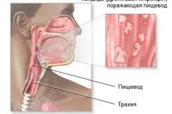 Стравохід будова, функції та особливості (будову) Стравохід будова, функції та особливості
