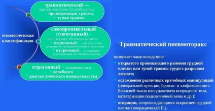 Пневмоторакс - шпаргалки для швидкої допомоги (допомоги) Пневмоторакс - шпаргалки для швидкої допомоги
