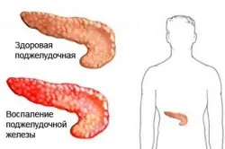 Пронос після молока причини