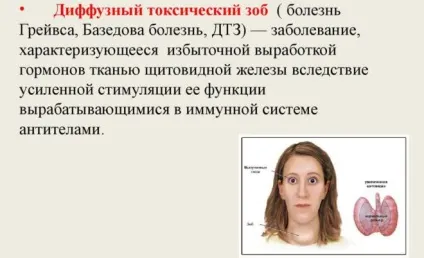 Післяопераційний гіпотиреоз щитовидної залози лікування (щитовидної) Післяопераційний гіпотиреоз щитовидної залози лікування