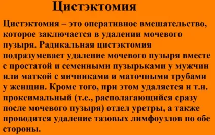 Наслідки та відгуки видалення сечового міхура у чоловіків (видалення) Наслідки та відгуки видалення сечового міхура у чоловіків