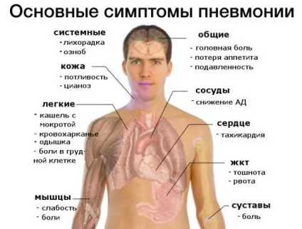 Після пневмонії як довго відновлюється організм реабілітація після хвороби у дорослих і дітей (після) Після пневмонії як довго відновлюється організм реабілітація після хвороби у дорослих і дітей