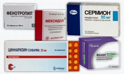 Минуще порушення мозкового кровообігу (порушення) Минуще порушення мозкового кровообігу