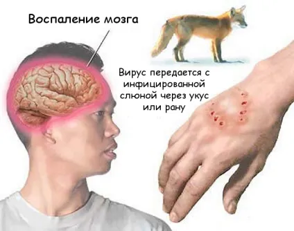 Ознаки сказу у людини після укусу кішки (людини) Ознаки сказу у людини після укусу кішки