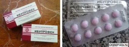 Псоріаз на ліктях фото, симптоми і лікування в домашніх умовах (фото) Псоріаз на ліктях фото, симптоми і лікування в домашніх умовах