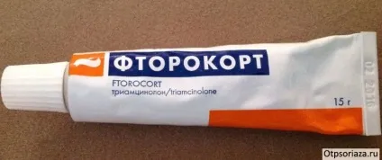 Псоріаз на ліктях фото, симптоми і лікування в домашніх умовах (ліктях) Псоріаз на ліктях фото, симптоми і лікування в домашніх умовах