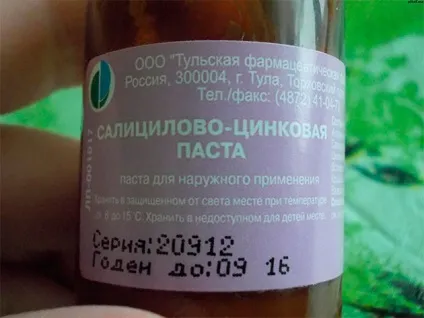 Псоріазних плями - причина появи і способи лікування