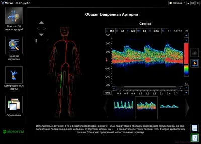 Vatlas - мультимедійний доплерографіческій 3d атлас судин на компакт диску (судин) Vatlas - мультимедійний доплерографіческій 3d атлас судин на компакт диску