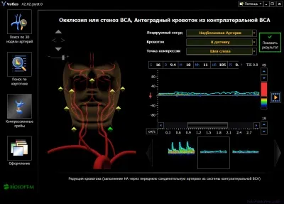 Vatlas - мультимедійний доплерографіческій 3d атлас судин на компакт диску (vatlas) Vatlas - мультимедійний доплерографіческій 3d атлас судин на компакт диску
